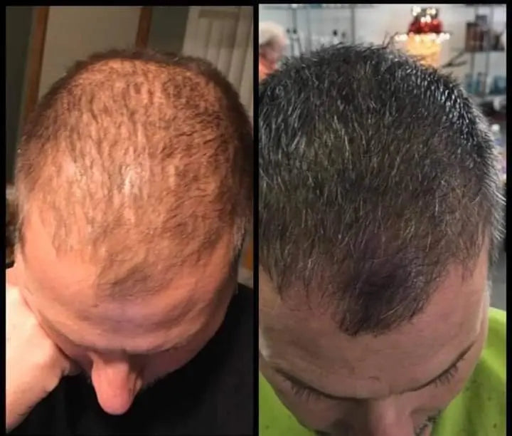 Hair Growth Glaze